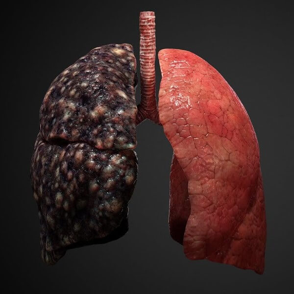 3D model of Lung